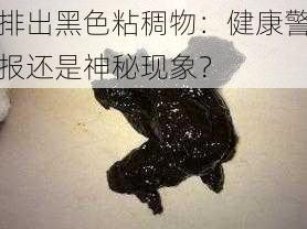 排出黑色粘稠物：健康警报还是神秘现象？