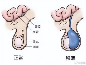 刑讯室睾丸—刑讯室睾丸，为何成了审讯的关键？