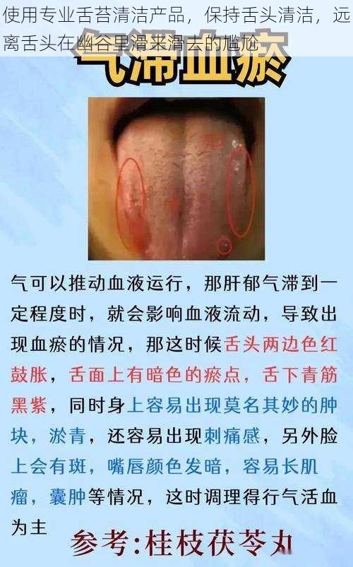 使用专业舌苔清洁产品,保持舌头清洁,远离舌头在幽谷里滑来滑去的尴尬