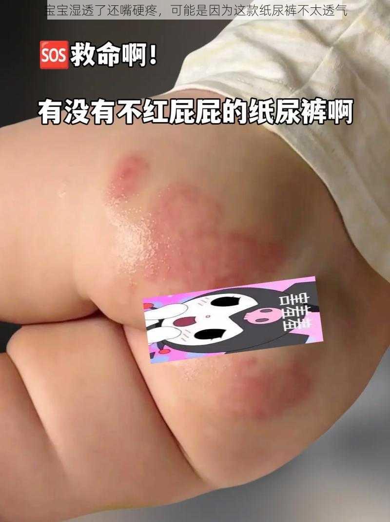 宝宝湿透了还嘴硬疼，可能是因为这款纸尿裤不太透气