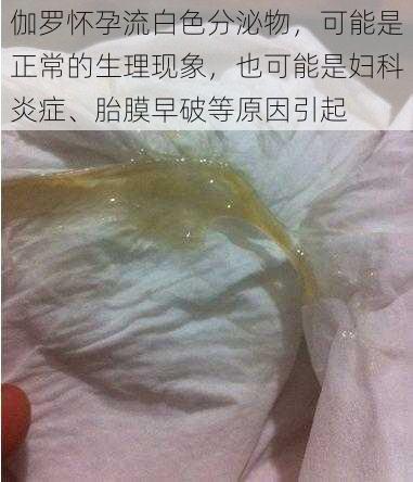 伽罗怀孕流白色分泌物，可能是正常的生理现象，也可能是妇科炎症、胎膜早破等原因引起