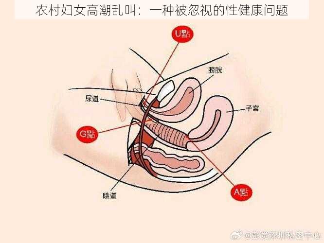 农村妇女高潮乱叫：一种被忽视的性健康问题